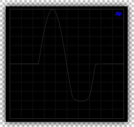 Clipping Distortion Severe Tube